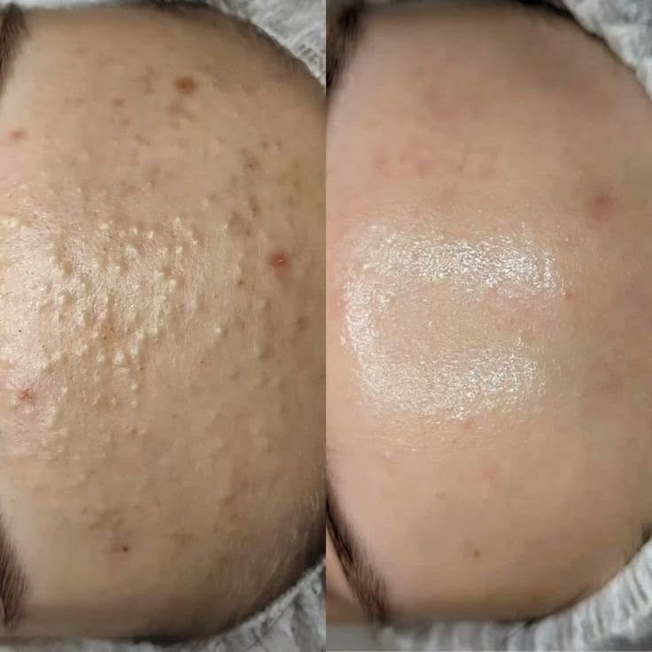 Lymphatic Drainage & Glo₂Facial Services