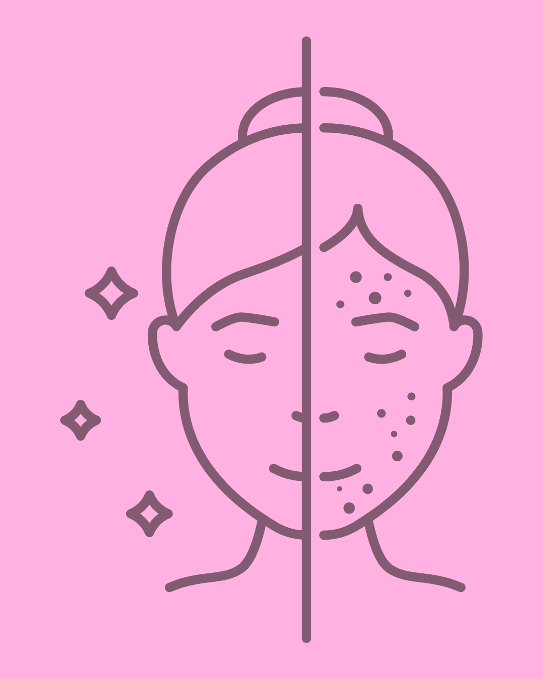Acne Facial Treatment 60 minutes