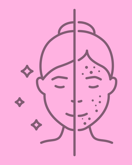 Acne Facial Treatment 60 minutes