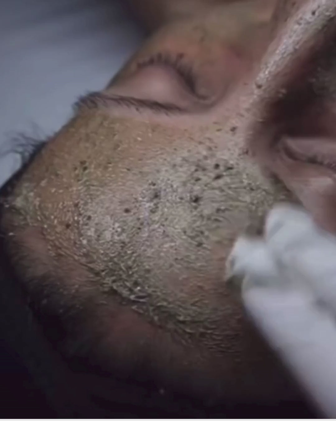 Deep Sea Facial Peel Tulsa, Oklahoma